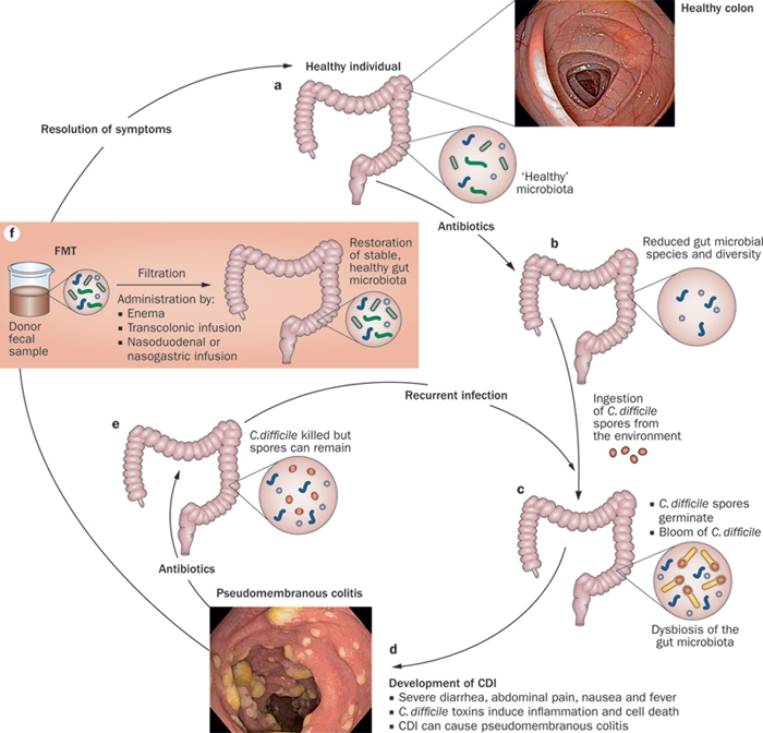 Journal of Lancaster General Health The Gut Flora